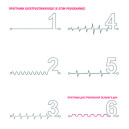 Вібратор з електростимуляцією Mystim Tickling Truman eStim Black